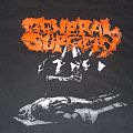 GENERAL SURGERY - TShirt or Longsleeve - GENERAL SURGERY EARLY 1990s NECROLOGY BAND SHIRT (RELAPSE RECORDS??)