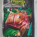 Haggus - Tape / Vinyl / CD / Recording etc - Haggus Medical malpractise and surgical extremities