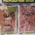 Ptoma - Tape / Vinyl / CD / Recording etc - Ptoma, Pulmonary Fibrosis ‎– Molten Abomination / Live At Anthem Of Steel