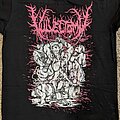 Vulvectomy - TShirt or Longsleeve - Vulvectomy Short Sleeve