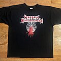 Cerebral Hemorrhage - TShirt or Longsleeve - Cerebral Hemorrhage Shirt