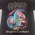 Malignancy - TShirt or Longsleeve - Malignancy - Intrauterine Cannibalism