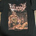 Vulvectomy - TShirt or Longsleeve - Vulvectomy Gangrenous Testicular Deformity T-Shirt/Back Print+Font