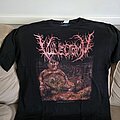 Vulvectomy - TShirt or Longsleeve - Vulvectomy Short sleeve
