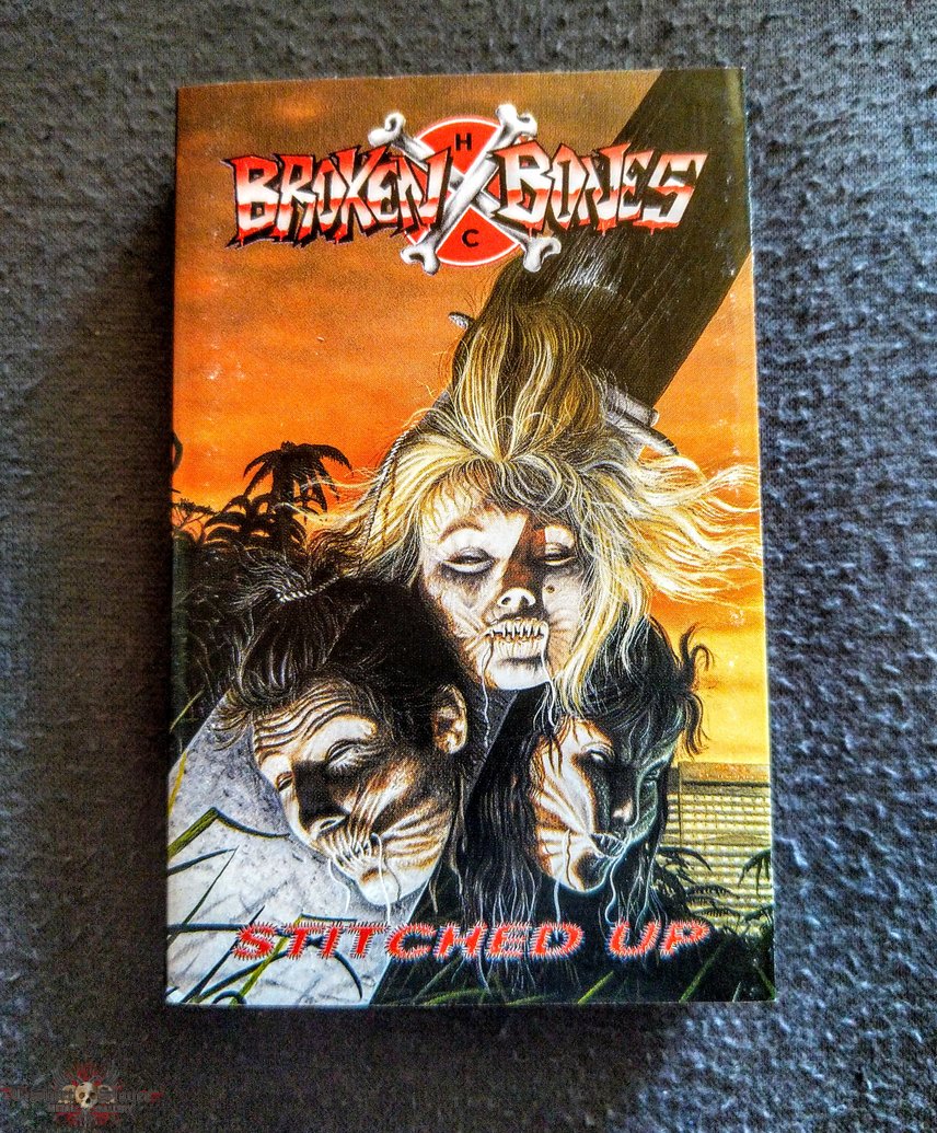 Broken Bones - Stitched Up MC Broken Bones - Stitched Up MC