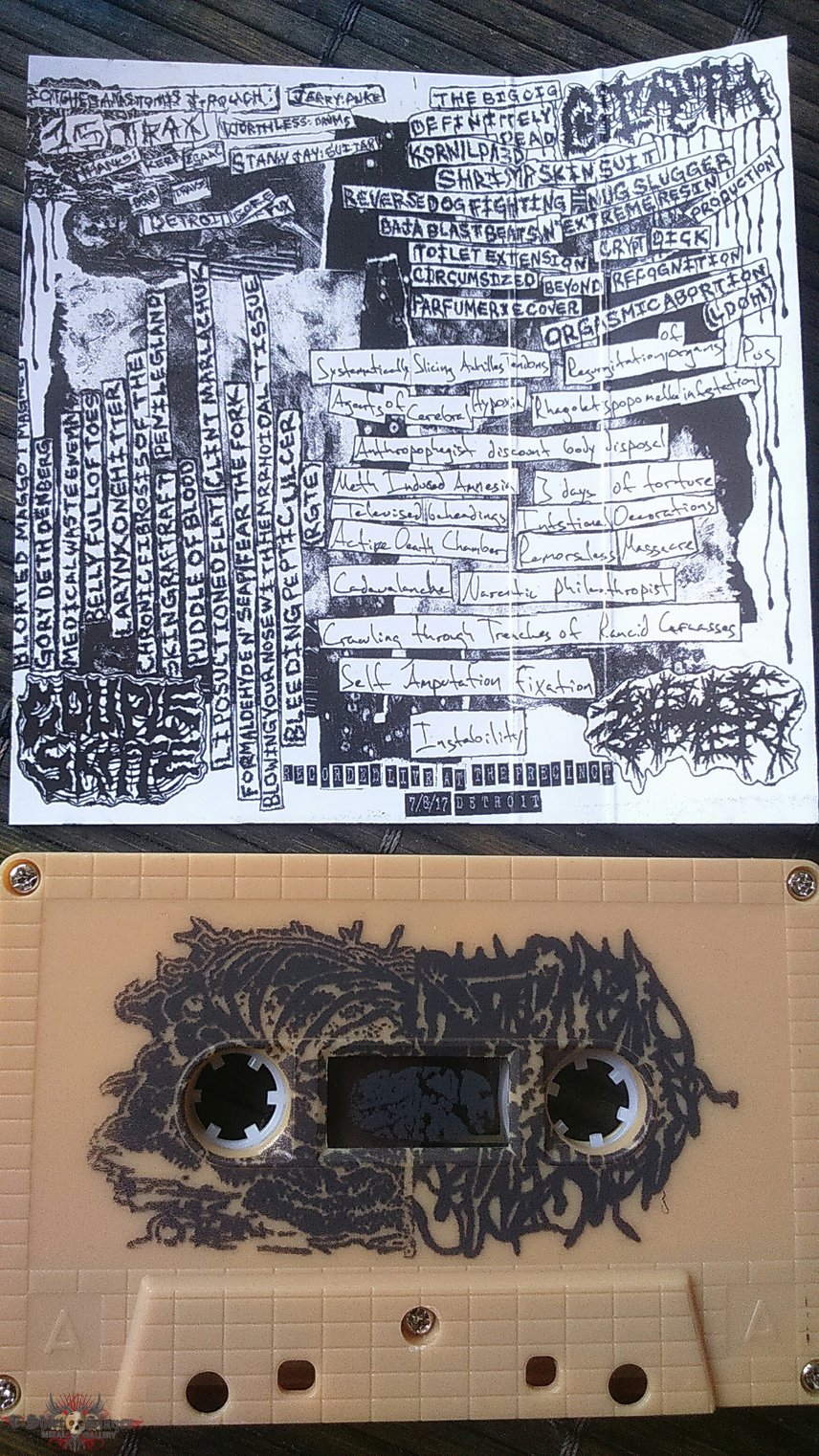 Sulfuric Cautery / Girth / Couple Skate / Botched Anastomosis J-Pouch spl 