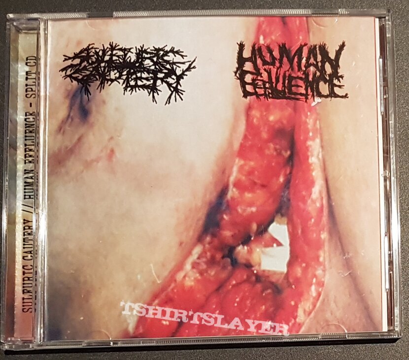 Sulfuric Cautery / Human Effluence Split 