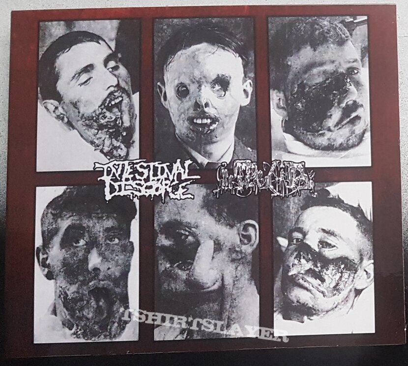 Intestinal Disgorge / Inopexia Split 