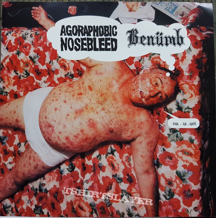 Agoraphobic Nosebleed / Benümb Split 