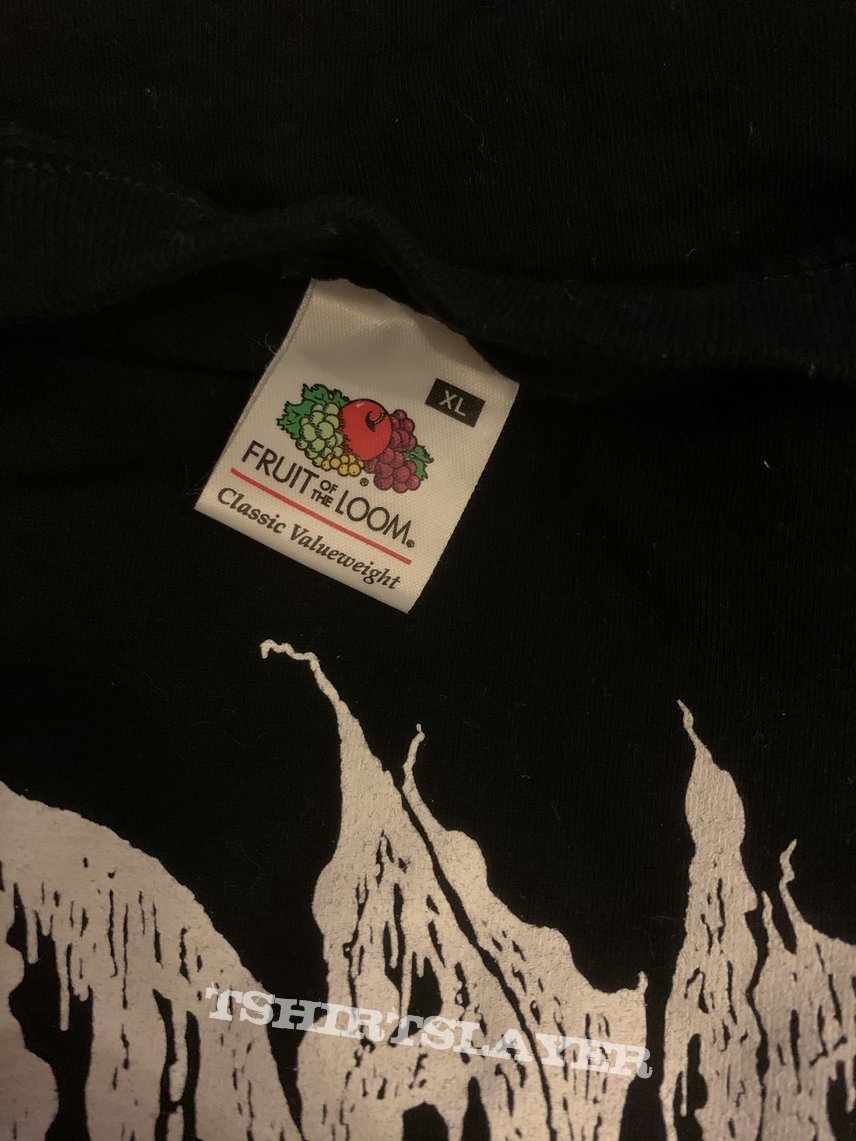 Cadaver - Abnormal Deformity