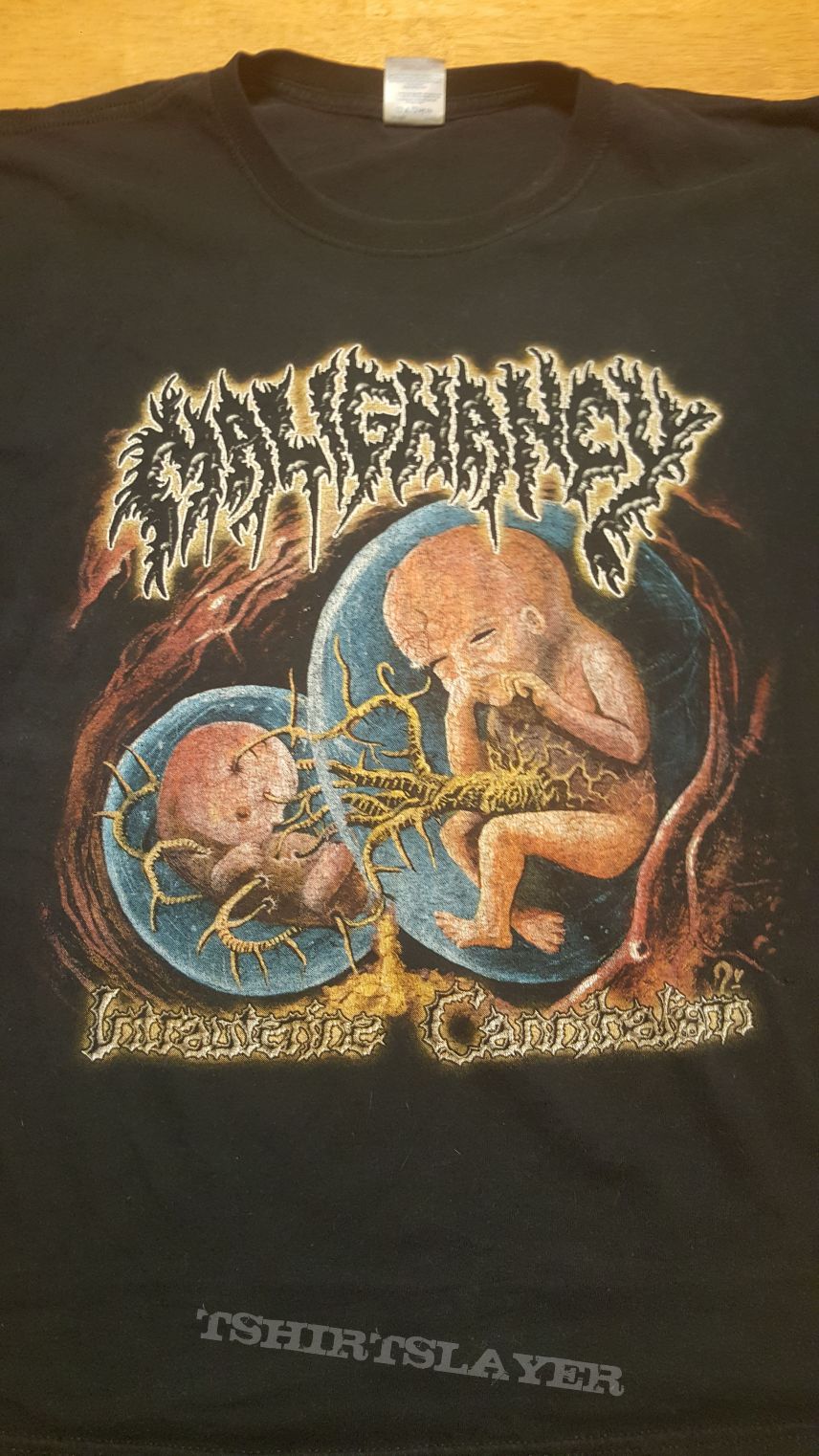 Malignancy - Intrauterine Cannibalism - SS - L