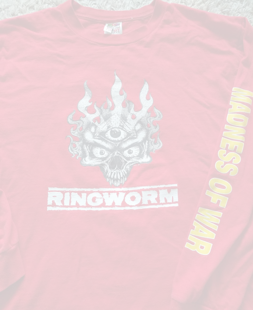 Ringworm