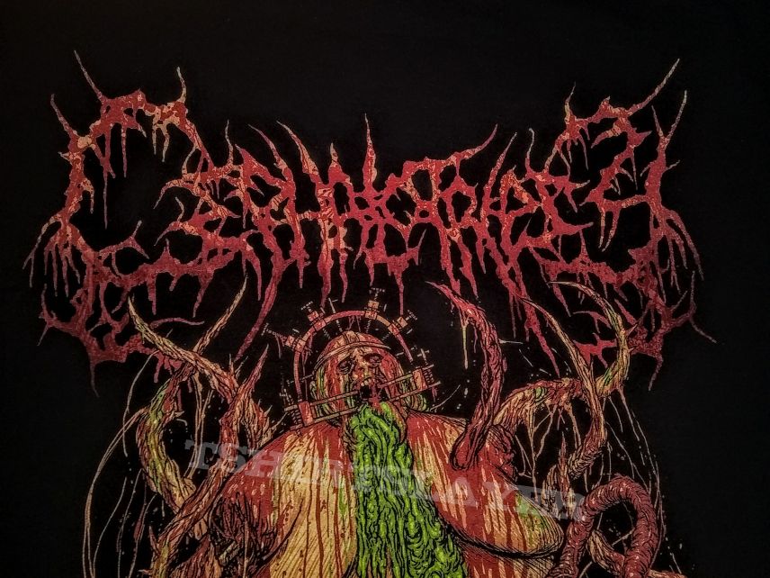 Cephalotripsy Ulcerated Mass of Pestilent Engorgement Hoodie