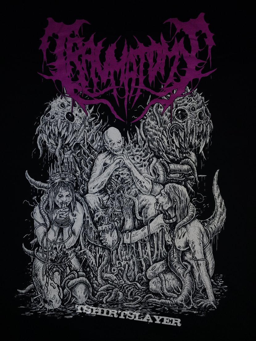 Traumatomy shirt