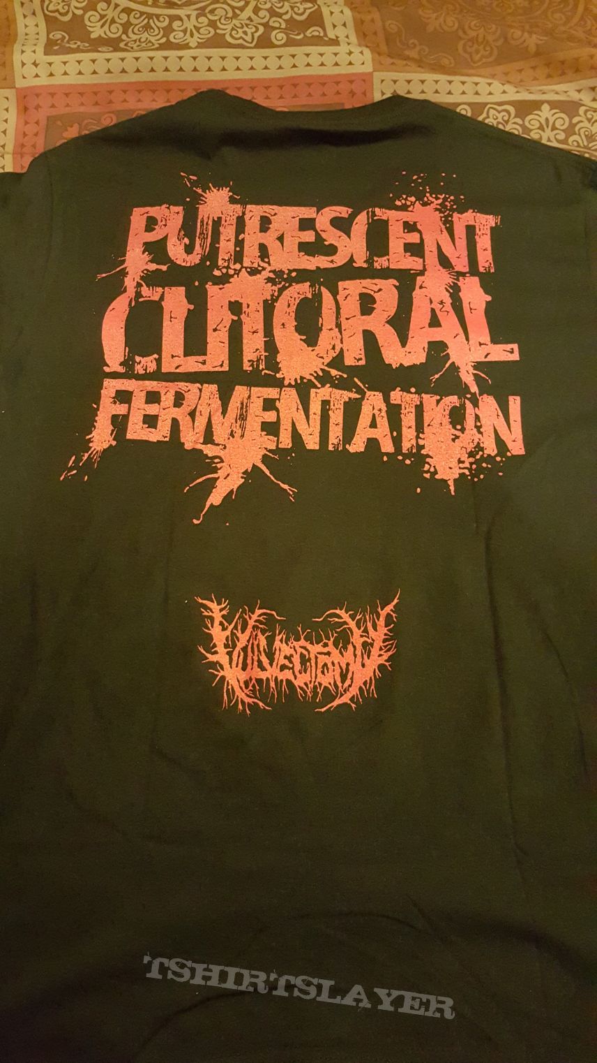 Vulvectomy - Putrescent Clitoral Fermentation