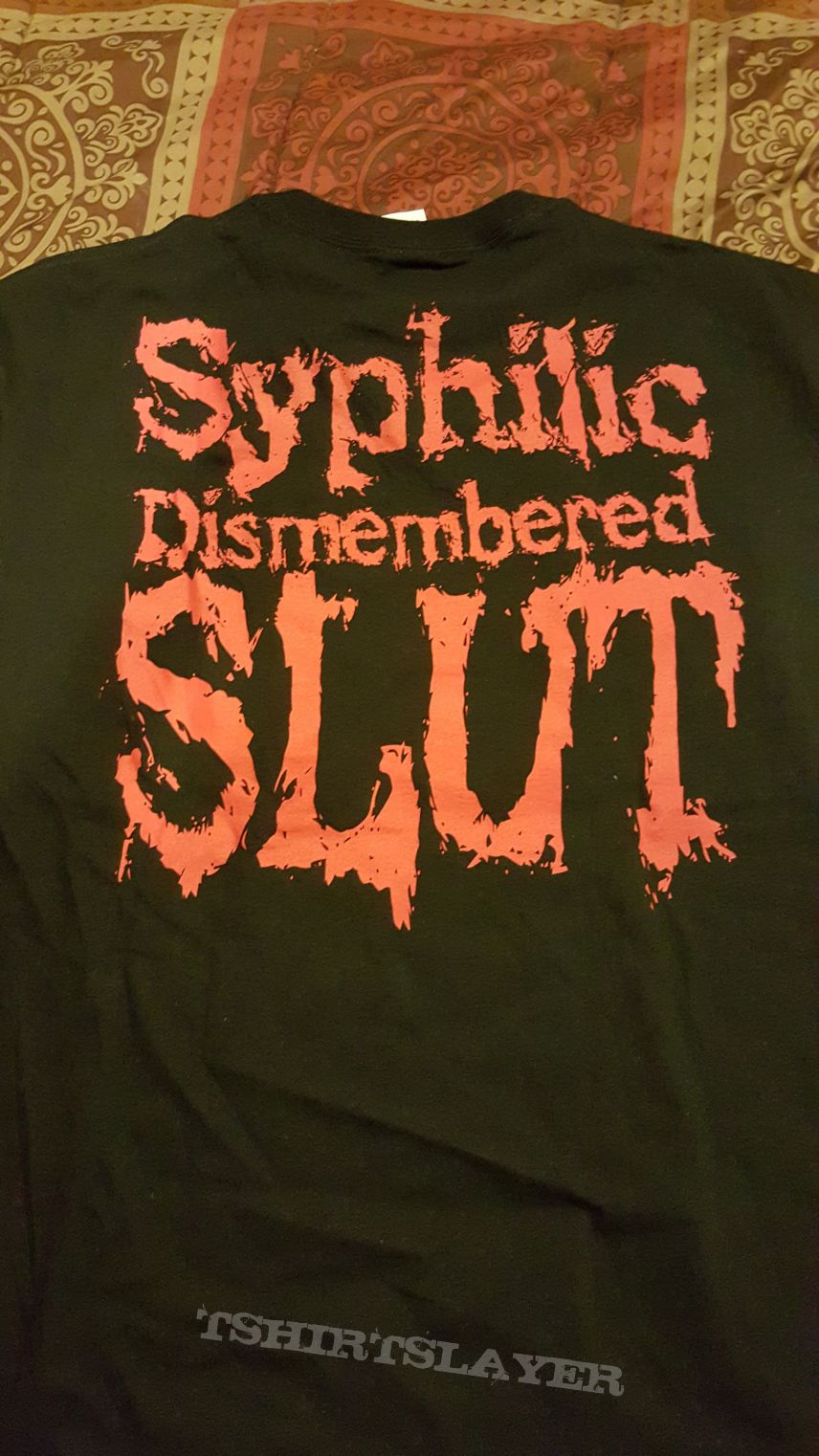 Vulvectomy Vuvlectomy - Syphilic Desmembered Slut