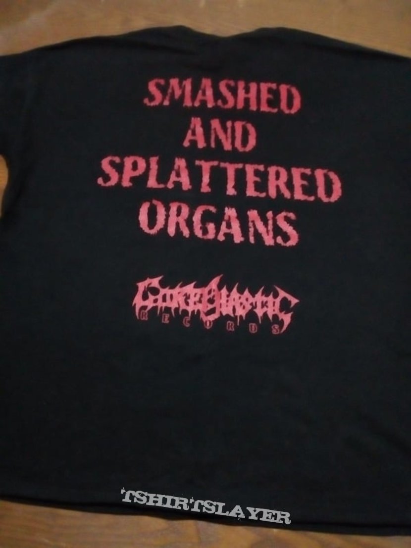  Cerebral Effusion   Smashed And Splattered Organs     T Shirt