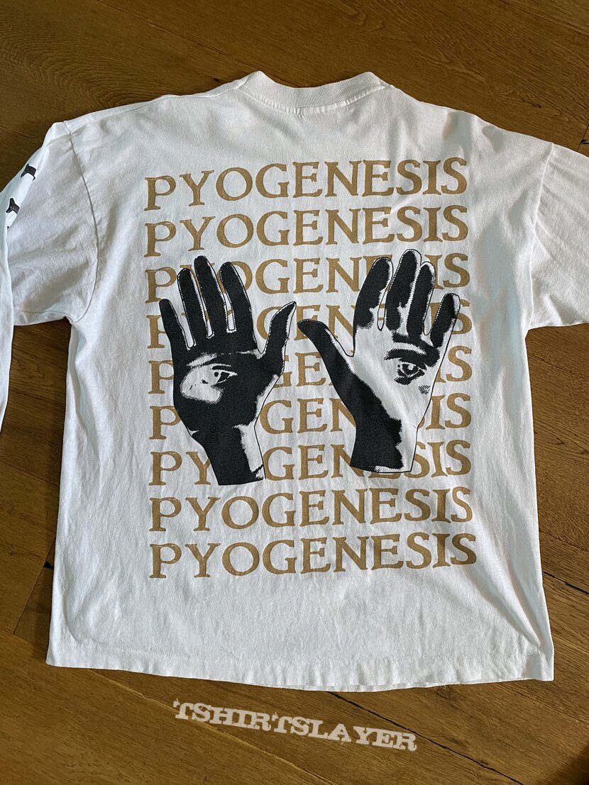 Pyogenesis