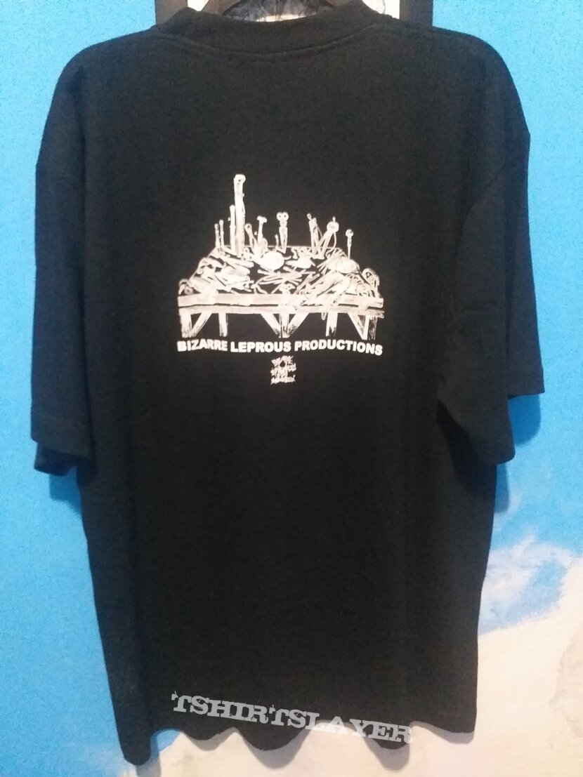 Putrid Pile split Dyscrasia (Genocide Of The Unborn Bodies On Display) Putrid Pile split Dyscrasia (Genocide Of The Unborn Bodies On Display)