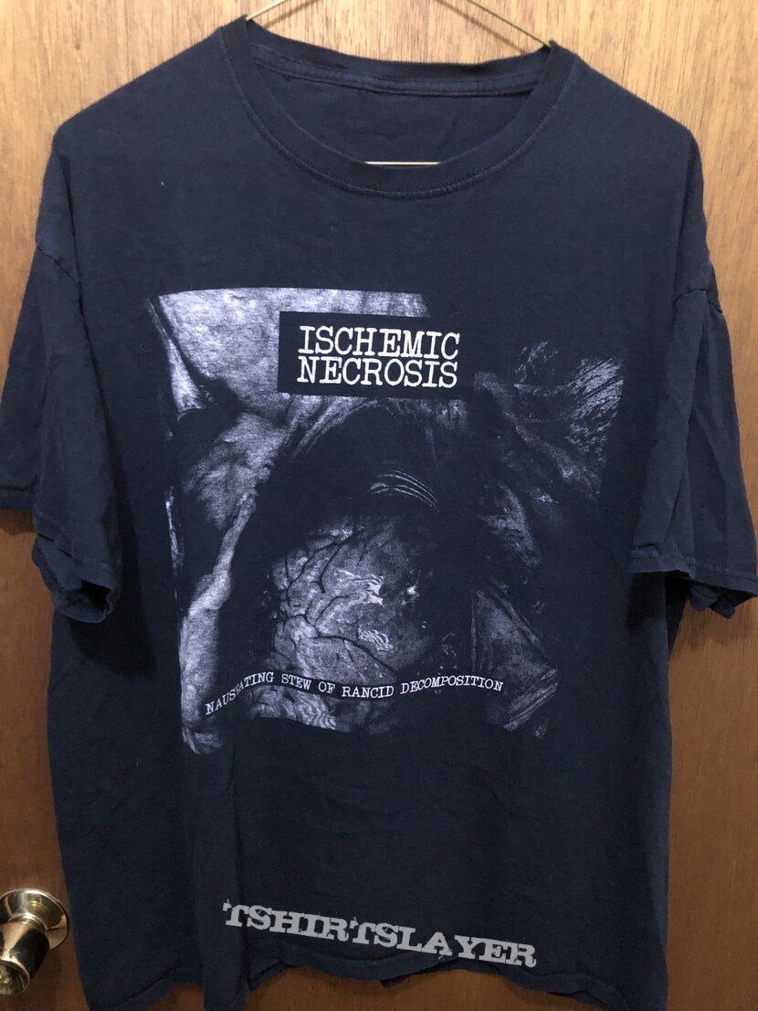 Ischemic Necrosis tee