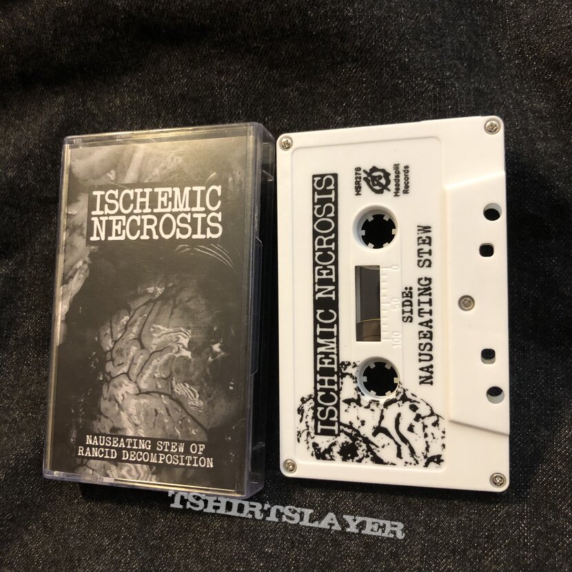 Ischemic Necrosis Cassette