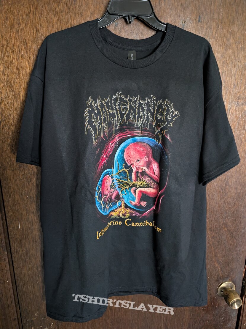 Malignancy Intrauterine Cannibalism tshirt Malignancy Intrauterine Cannibalism tshirt