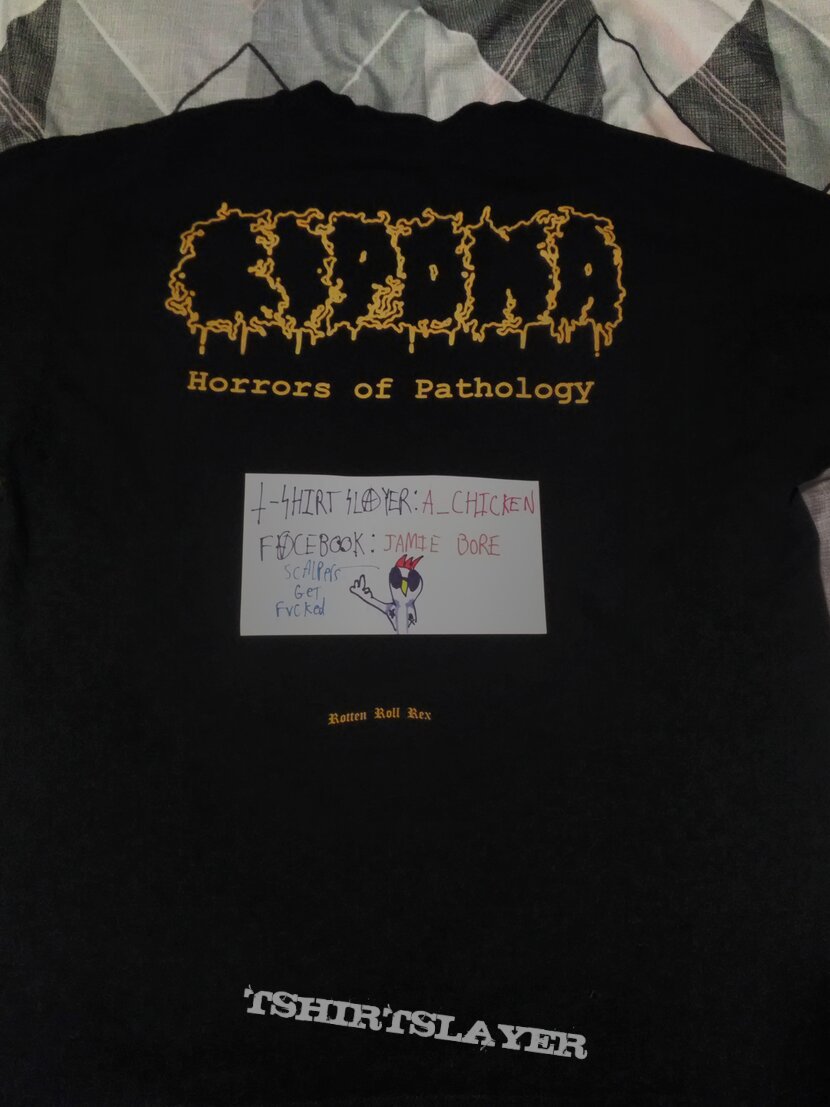 Lipoma - Horrors of Pathology shirt