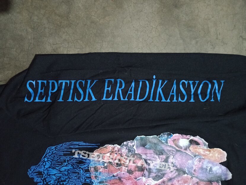 Septage-Septisk eradikasyon