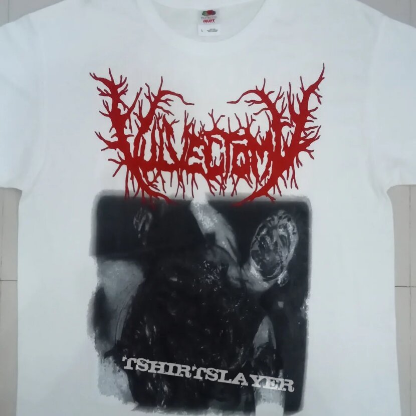 Vulvectomy - Syphilic Dismembered Slut