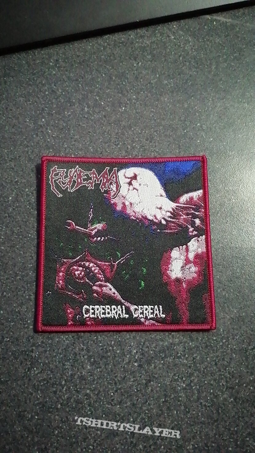 Pyaemia - Celebral cereal Pyaemia - Celebral cereal